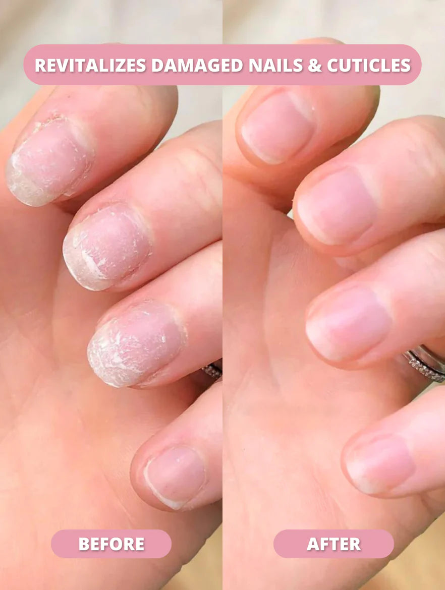 Nail Growth Serum
