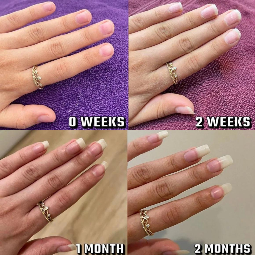 Nail Growth Serum